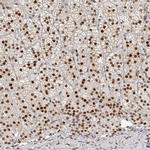 ZNF503 Antibody in Immunohistochemistry (IHC)