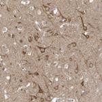 USE1 Antibody in Immunohistochemistry (Paraffin) (IHC (P))