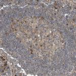 USE1 Antibody in Immunohistochemistry (Paraffin) (IHC (P))