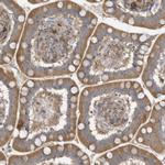 USE1 Antibody in Immunohistochemistry (Paraffin) (IHC (P))