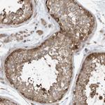 USE1 Antibody in Immunohistochemistry (Paraffin) (IHC (P))