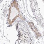 Stabilin 2 Antibody in Immunohistochemistry (IHC)