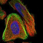 SCNN1D Antibody in Immunocytochemistry (ICC/IF)