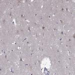 SCNN1D Antibody in Immunohistochemistry (Paraffin) (IHC (P))