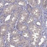 SCNN1D Antibody in Immunohistochemistry (Paraffin) (IHC (P))