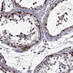 SCNN1D Antibody in Immunohistochemistry (IHC)