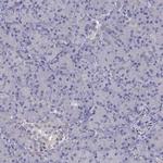 SCNN1D Antibody in Immunohistochemistry (IHC)