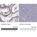 SCNN1D Antibody