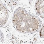 SLC25A26 Antibody in Immunohistochemistry (IHC)