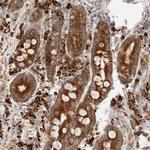 UTS2B Antibody in Immunohistochemistry (Paraffin) (IHC (P))