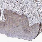 SRD5A3 Antibody in Immunohistochemistry (Paraffin) (IHC (P))