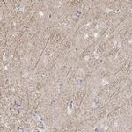 Kir2.2 (KCNJ12) Antibody in Immunohistochemistry (IHC)