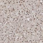 EYA2 Antibody in Immunohistochemistry (IHC)