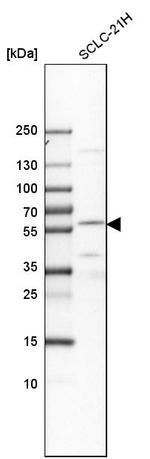 EYA2 Antibody in Western Blot (WB)