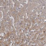 PPP1R3C Antibody in Immunohistochemistry (Paraffin) (IHC (P))