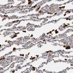 PPP1R3C Antibody in Immunohistochemistry (Paraffin) (IHC (P))