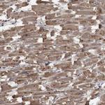 PPP1R3C Antibody in Immunohistochemistry (IHC)