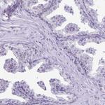 Caspase 14 Antibody in Immunohistochemistry (Paraffin) (IHC (P))