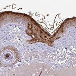 Caspase 14 Antibody in Immunohistochemistry (Paraffin) (IHC (P))