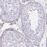 Caspase 14 Antibody in Immunohistochemistry (Paraffin) (IHC (P))