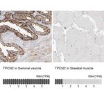 TPCN2 Antibody in Immunohistochemistry (IHC)