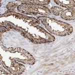 TPCN2 Antibody in Immunohistochemistry (IHC)