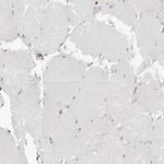 TPCN2 Antibody in Immunohistochemistry (IHC)