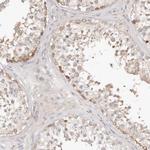 TTLL4 Antibody in Immunohistochemistry (Paraffin) (IHC (P))