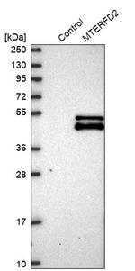 MTERFD2 Antibody in Western Blot (WB)