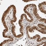 ADPRHL2 Antibody in Immunohistochemistry (Paraffin) (IHC (P))