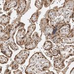 ADPRHL2 Antibody in Immunohistochemistry (Paraffin) (IHC (P))