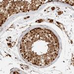 ADPRHL2 Antibody in Immunohistochemistry (Paraffin) (IHC (P))