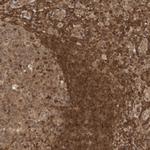 ADPRHL2 Antibody in Immunohistochemistry (Paraffin) (IHC (P))