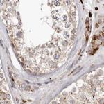 NUP43 Antibody in Immunohistochemistry (IHC)