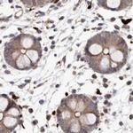 NUP43 Antibody in Immunohistochemistry (IHC)