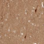 BAALC Antibody in Immunohistochemistry (Paraffin) (IHC (P))