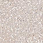 BAALC Antibody in Immunohistochemistry (Paraffin) (IHC (P))