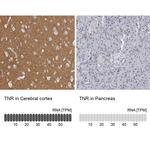 Tenascin R Antibody in Immunohistochemistry (IHC)