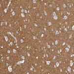 Tenascin R Antibody in Immunohistochemistry (IHC)