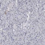 Tenascin R Antibody in Immunohistochemistry (IHC)