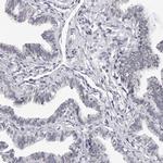 GNL2 Antibody in Immunohistochemistry (IHC)