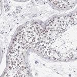 GNL2 Antibody in Immunohistochemistry (IHC)