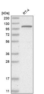 GNL2 Antibody in Western Blot (WB)