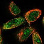 CCBL2 Antibody in Immunocytochemistry (ICC/IF)