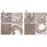 CCBL2 Antibody in Immunohistochemistry (IHC)