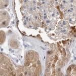 CCBL2 Antibody in Immunohistochemistry (IHC)