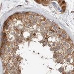 CCBL2 Antibody in Immunohistochemistry (IHC)