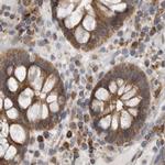 CCBL2 Antibody in Immunohistochemistry (IHC)