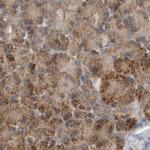 CCBL2 Antibody in Immunohistochemistry (IHC)