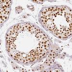 KDM5B Antibody in Immunohistochemistry (IHC)